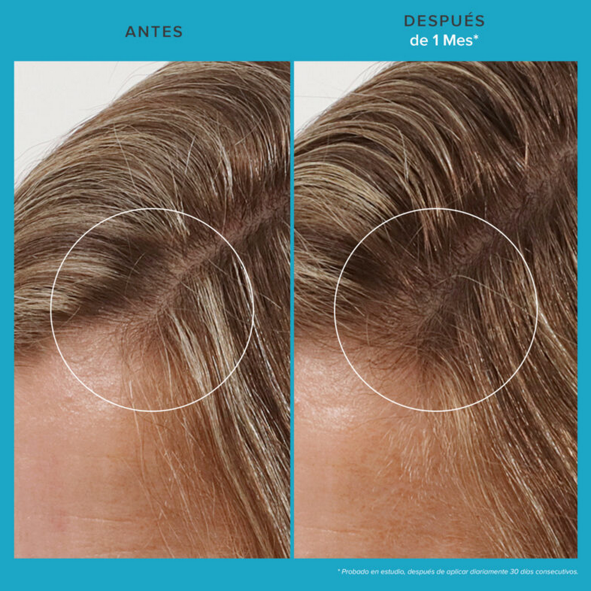 Scalp Care Revitalizing Treatment 73ml LIVING PROOF - Imagen 3